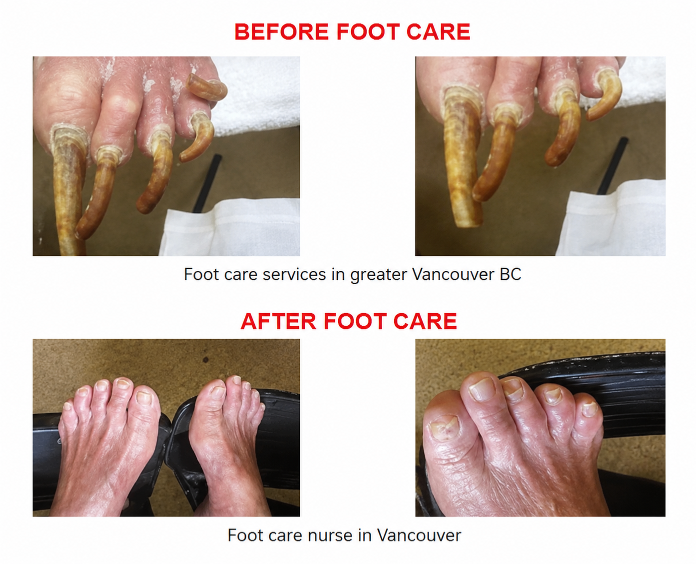 Registered nurse providing professional foot care to a senior client